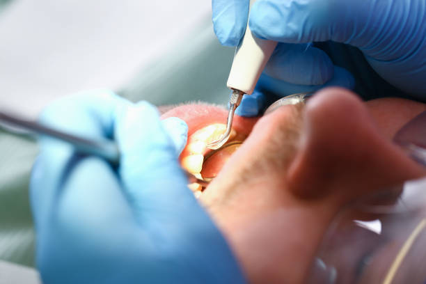 Best Cosmetic Emergency Dentistry in Rion Center, MA