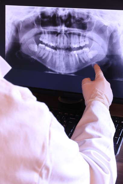 Best Emergency Treatment for Dental Infections or Abscesses in Rion Center, MA